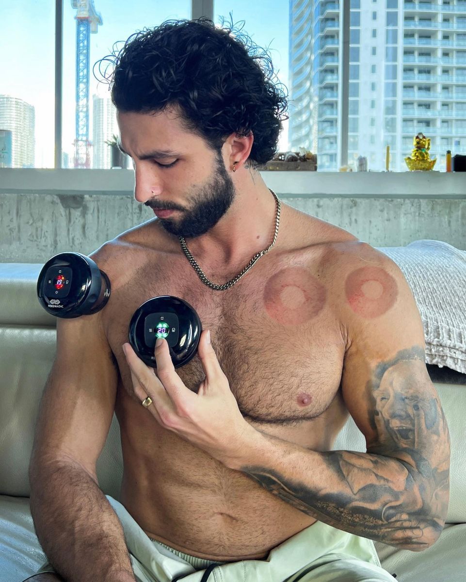 Revomadic Review – Smart Cupping Therapy for Pain Relief, Recovery & Everyday Wellness